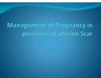 4-Management of placenta insertion on uterus scar of c-section
